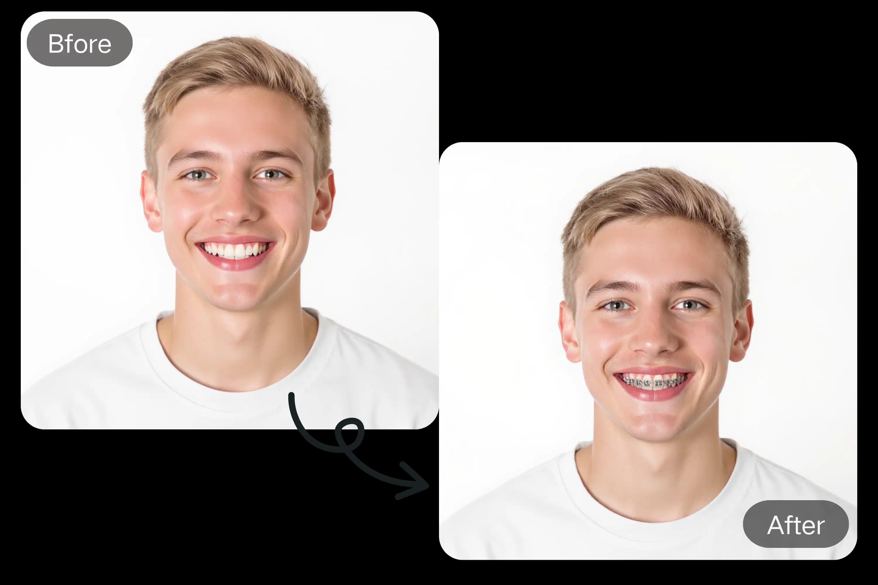 Virtual Braces Try-On Before Orthodontic Treatment