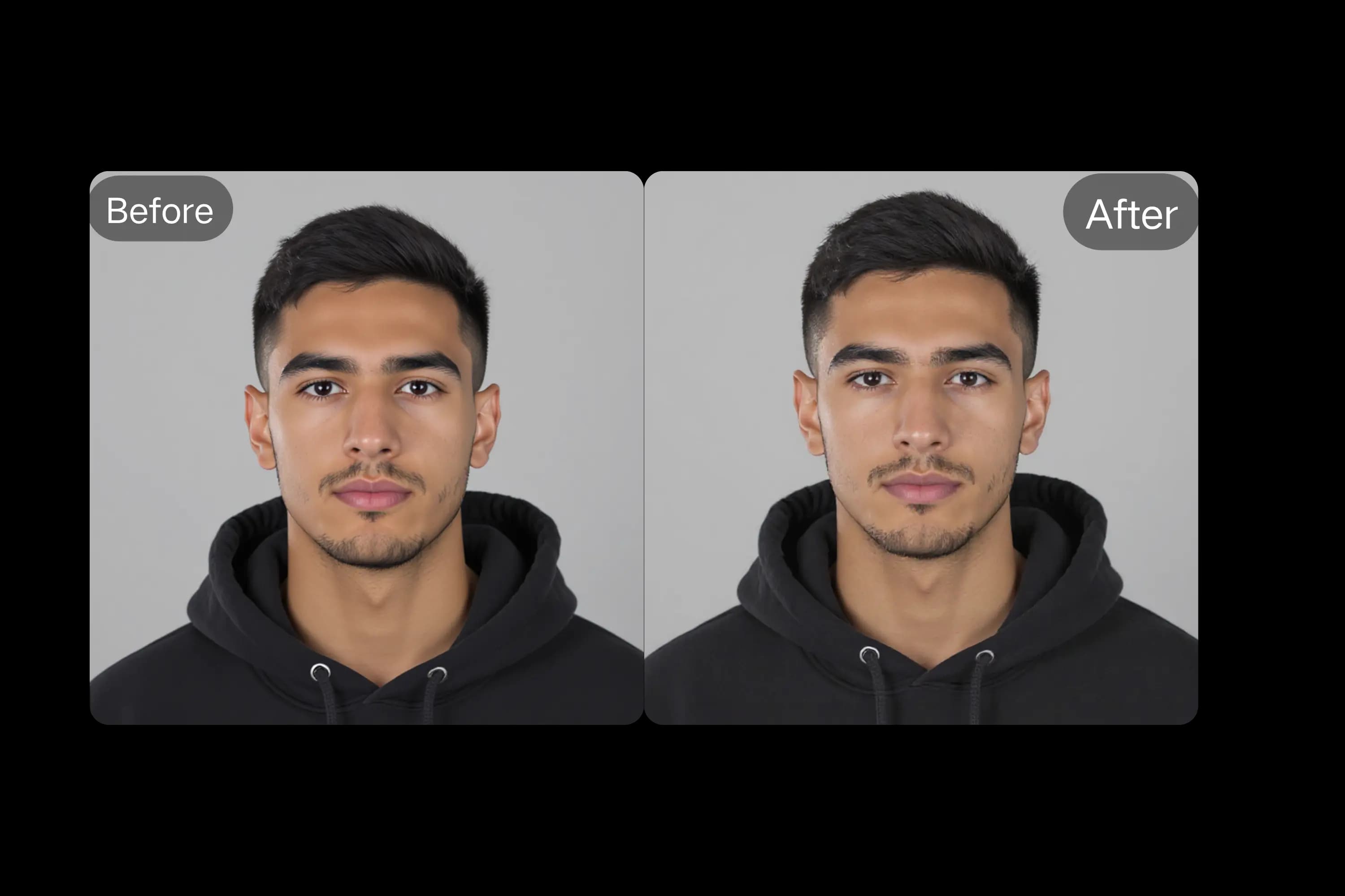 Advanced Face Slimming and Shaping